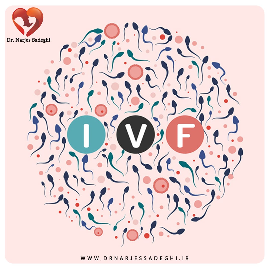 IVF چیست؟